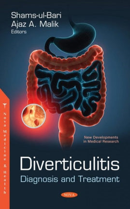 Diverticulitis: Diagnosis and Treatment