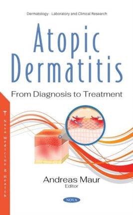 Atopic Dermatitis: From Diagnosis to Treatment