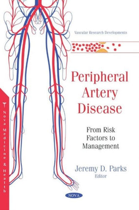 Peripheral Artery Disease: From Risk Factors to Management