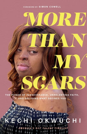 More Than My Scars – The Power of Perseverance,