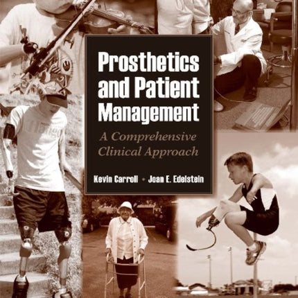 Prosthetics and Patient Management: A Comprehensive Clinical Approach