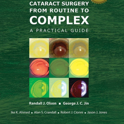 Cataract Surgery from Routine to Complex: A