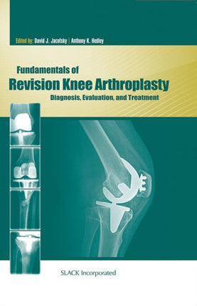 Fundamentals of Revision Knee Arthroplasty: Diagnosis, Evaluation, and Treatment