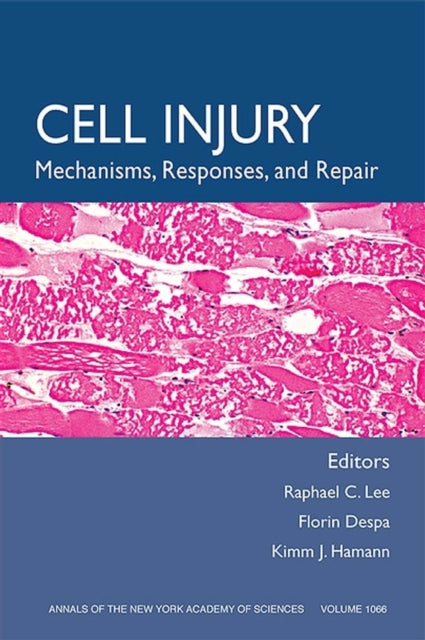 Cell Injury: Mechanisms, Responses, and Therapeutics, Volume 1066