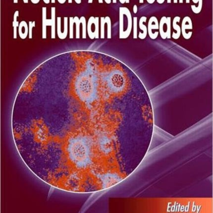 Nucleic Acid Testing for Human Disease