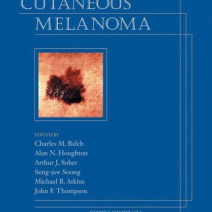 Cutaneous Melanoma, Fifth Edition