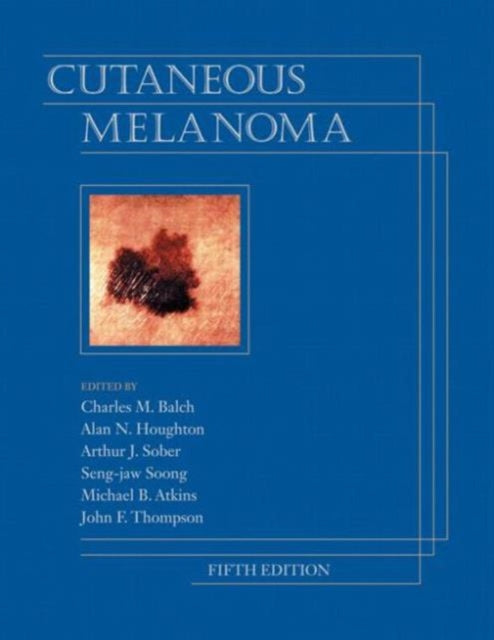 Cutaneous Melanoma, Fifth Edition