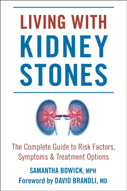 Living With Kidney Stones