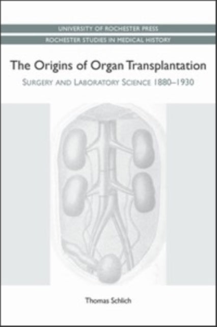 The Origins of Organ Transplantation: Surgery and Laboratory Science, 1880-1930