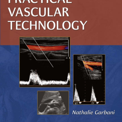 Practical Vascular Technology: A Comprehensive Laboratory Text