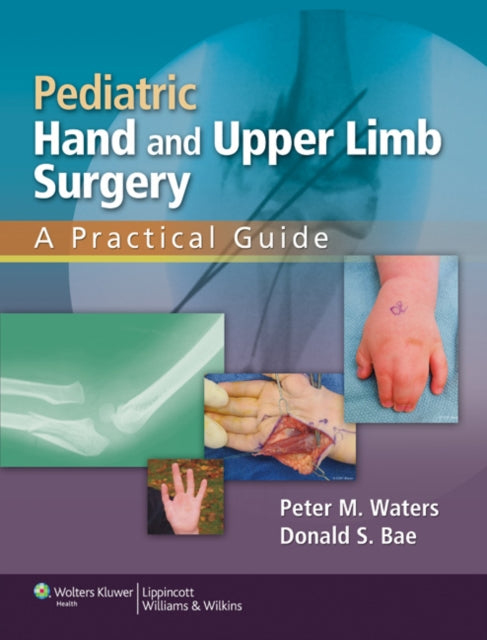 Pediatric Hand and Upper Limb Surgery: A Practical Guide