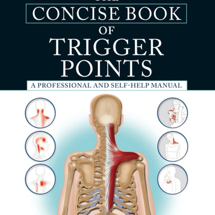 The Concise Book of Trigger Points, Third Edition: A Professional and Self-Help Manual