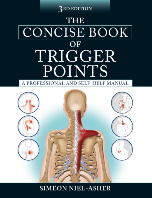 The Concise Book of Trigger Points, Third Edition: A Professional and Self-Help Manual