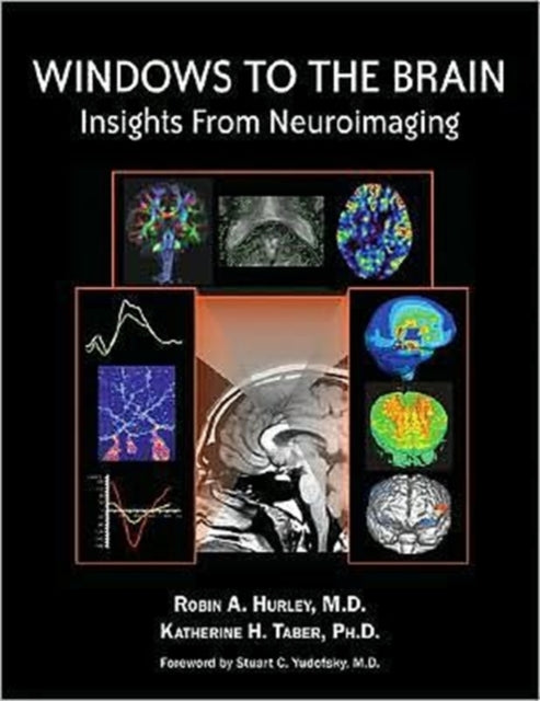 Windows to the Brain: Insights From Neuroimaging