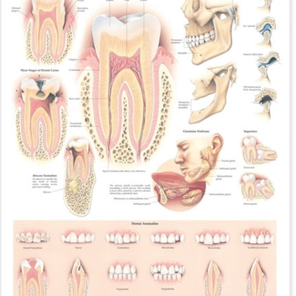 Disorders of the Teeth and Jaw Anatomical Chart