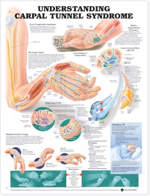 Understanding Carpal Tunnel Syndrome Anatomical Chart