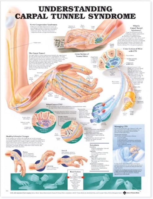 Understanding Carpal Tunnel Syndrome Anatomical