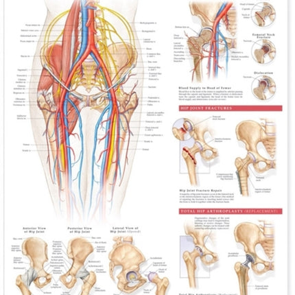 Anatomy and Injuries of the Hip Anatomical Chart