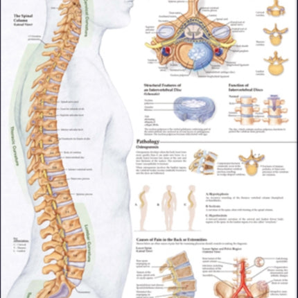 Human Spine Disorders Anatomical Chart