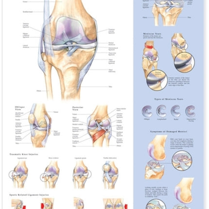 Knee Injuries Anatomical Chart