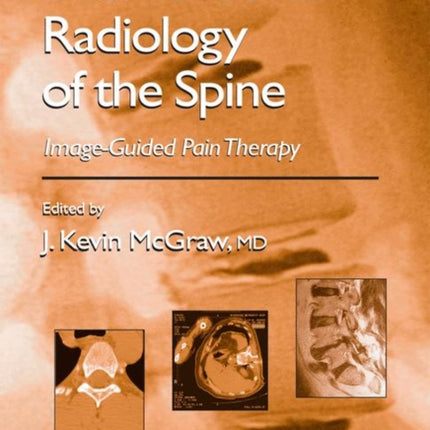 Interventional Radiology of the Spine: