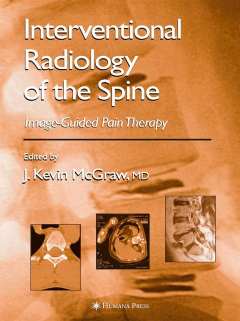 Interventional Radiology of the Spine: