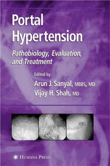 Portal Hypertension: Pathobiology, Evaluation, and Treatment