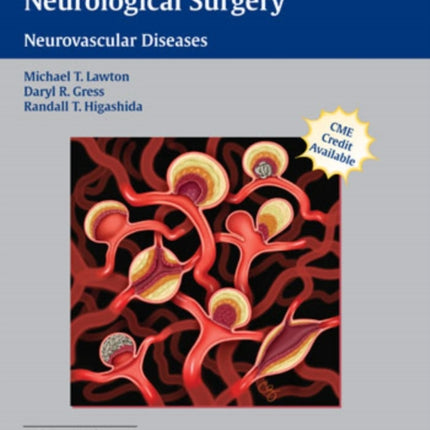 Controversies in Neurological Surgery: Neurovascular Diseases