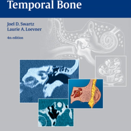 Imaging of the Temporal Bone