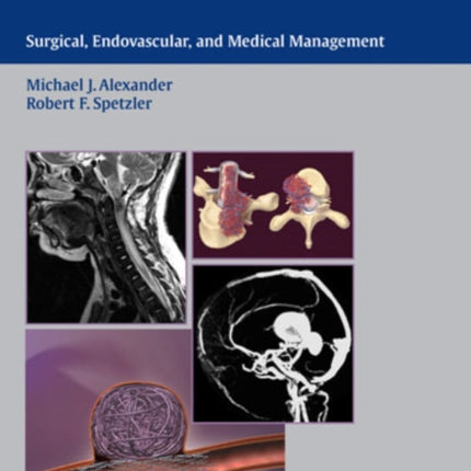 Pediatric Neurovascular Disease: Surgical, Endovascular and Medical Management