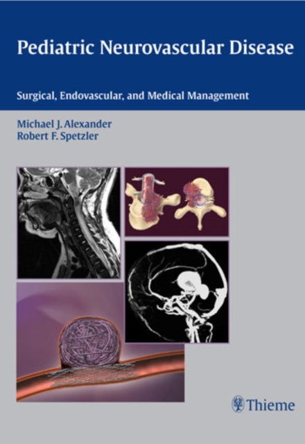 Pediatric Neurovascular Disease: Surgical, Endovascular and Medical Management