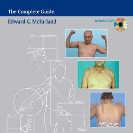 Examination of the Shoulder: The Complete Guide