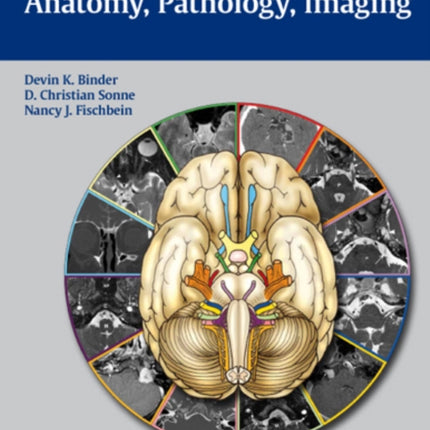 Cranial Nerves: Anatomy, Pathology, Imaging