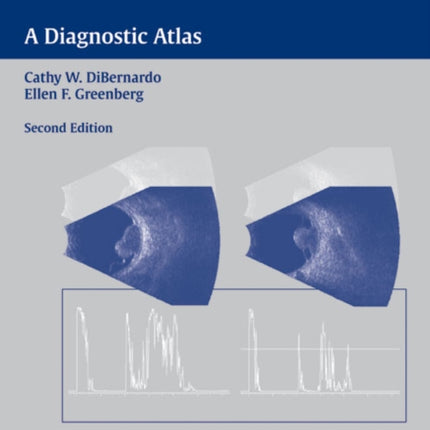 Ophthalmic Ultrasound: A Diagnostic Atlas