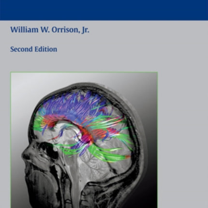 Atlas of Brain Function