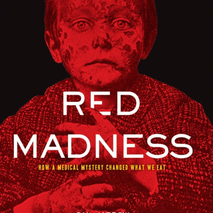 Red Madness: How a Medical Mystery Changed What We Eat