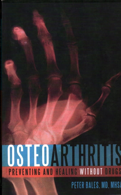 Osteoarthritis: Preventing and Healing Without