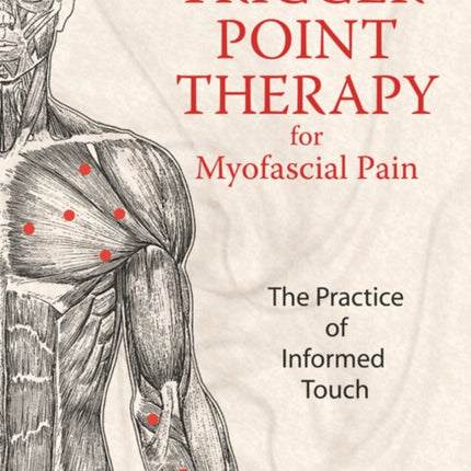 Trigger Point Therapy for Myofascial Pain: The