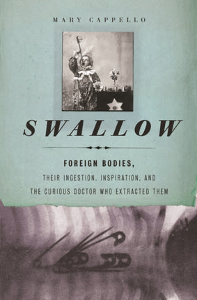 Swallow Foreign Bodies Their Ingestion Inspiration and the Curious Doctor Who Extracted Them