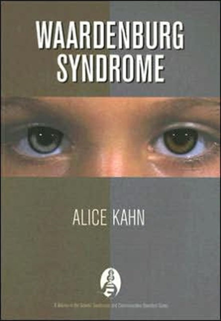 Waardenburg Syndrome