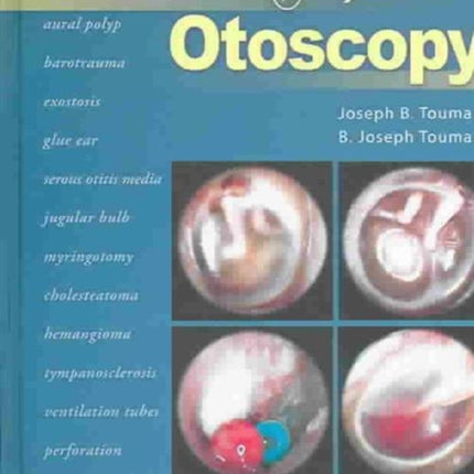 Atlas of Otoscopy