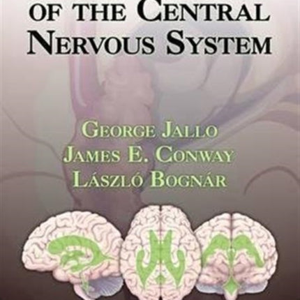 Neuroendoscopy of the Central Nervous System