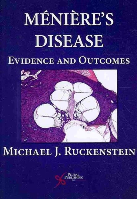 Meniere's Disease: Evidence and Outcomes