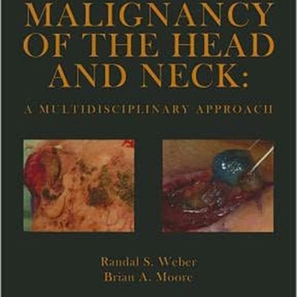 Cutaneous Malignancy of the Head and Neck: A Multidisciplinary Approach