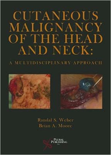 Cutaneous Malignancy of the Head and Neck: A Multidisciplinary Approach