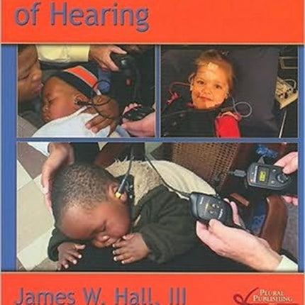 Objective Assessment of Hearing