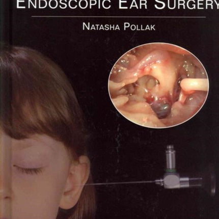 Endoscopic Ear Surgery