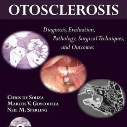 Otosclerosis