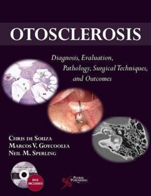 Otosclerosis