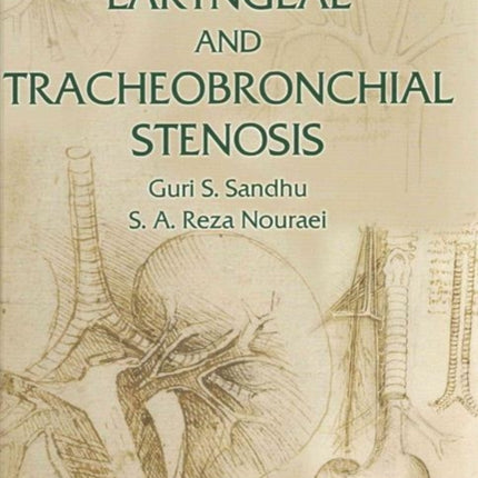 Laryngeal and Tracheobronchial Stenosis